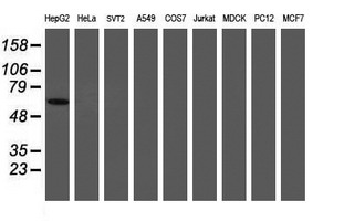 PGM3 Antibody - Western blot of extracts (35ug) from 9 different cell lines by using anti-PGM3 monoclonal antibody (HepG2: human; HeLa: human; SVT2: mouse; A549: human; COS7: monkey; Jurkat: human; MDCK: canine; PC12: rat; MCF7: human).