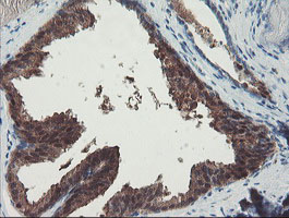 PGM3 Antibody - IHC of paraffin-embedded Human prostate tissue using anti-PGM3 mouse monoclonal antibody. (Heat-induced epitope retrieval by 10mM citric buffer, pH6.0, 100C for 10min).