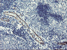 PGM3 Antibody - IHC of paraffin-embedded Human tonsil using anti-PGM3 mouse monoclonal antibody. (Heat-induced epitope retrieval by 10mM citric buffer, pH6.0, 100C for 10min).