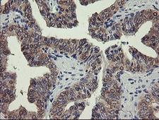 PGM3 Antibody - IHC of paraffin-embedded Human prostate tissue using anti-PGM3 mouse monoclonal antibody.