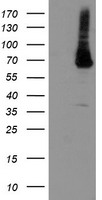 PGM3 Antibody - HEK293T cells were transfected with the pCMV6-ENTRY control (Left lane) or pCMV6-ENTRY PGM3 (Right lane) cDNA for 48 hrs and lysed. Equivalent amounts of cell lysates (5 ug per lane) were separated by SDS-PAGE and immunoblotted with anti-PGM3.