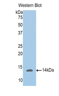 PGM5 / Aciculin Antibody - Western blot of recombinant PGM5 / Aciculin.  This image was taken for the unconjugated form of this product. Other forms have not been tested.