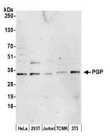 PGP Antibody - Detection of human and mouse PGP by western blot. Samples: Whole cell lysate (15 µg) from HeLa, HEK293T, Jurkat, mouse TCMK-1, and mouse NIH 3T3 cells prepared using NETN lysis buffer. Antibody: Affinity purified rabbit anti-PGP antibody used for WB at 1:1000. Detection: Chemiluminescence with an exposure time of 3 minutes.