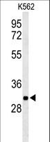 PGP Antibody - Western blot of PGP Antibody in K562 cell line lysates (35 ug/lane). PGP (arrow) was detected using the purified antibody.