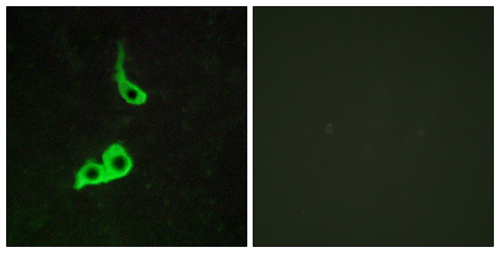 PGR1 / GPR153 Antibody - Immunofluorescence analysis of LOVO cells, using GPR153 Antibody. The picture on the right is blocked with the synthesized peptide.