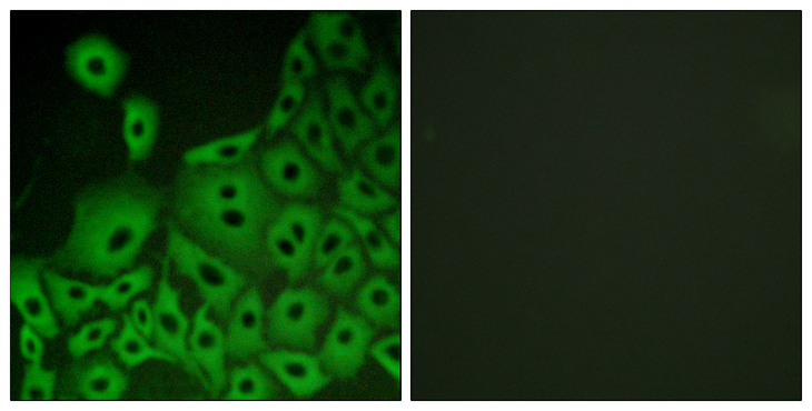 PGR1 / GPR153 Antibody - Immunofluorescence analysis of A549 cells, using GPR153 Antibody. The picture on the right is blocked with the synthesized peptide.