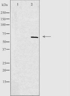 PGR1 / GPR153 Antibody - Western blot analysis of extracts of K562 cells using GPR153 antibody. The lane on the left is treated with the antigen-specific peptide.
