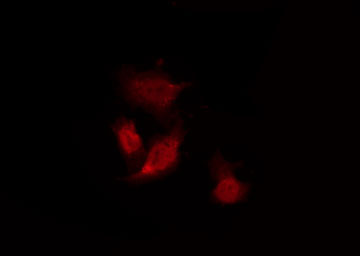 PGR1 / GPR153 Antibody - Staining HeLa cells by IF/ICC. The samples were fixed with PFA and permeabilized in 0.1% Triton X-100, then blocked in 10% serum for 45 min at 25°C. The primary antibody was diluted at 1:200 and incubated with the sample for 1 hour at 37°C. An Alexa Fluor 594 conjugated goat anti-rabbit IgG (H+L) Ab, diluted at 1/600, was used as the secondary antibody.