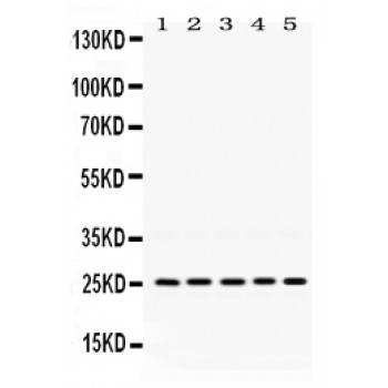 PGRMC1 / MPR Antibody - PGRMC1 antibody Western blot. All lanes: Anti PGRMC1 at 0.5 ug/ml. Lane 1: Rat Liver Tissue Lysate at 50 ug. Lane 2: Rat Kidney Tissue Lysate at 50 ug. Lane 3: Mouse Liver Tissue Lysate at 50 ug. Lane 4: Mouse Kidney Tissue Lysate at 50 ug. Lane 5: SMMC Whole Cell Lysate at 40 ug. Predicted band size: 26 kD. Observed band size: 26 kD.