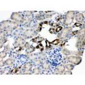 PGRMC1 / MPR Antibody - PGRMC1 antibody IHC-paraffin. IHC(P): Mouse Kidney Tissue.