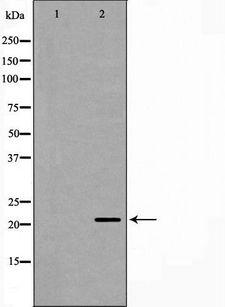 PGRMC1 / MPR Antibody - Western blot analysis of mouse liver tissue lysates using PGRMC1 antibody. The lane on the left is treated with the antigen-specific peptide.