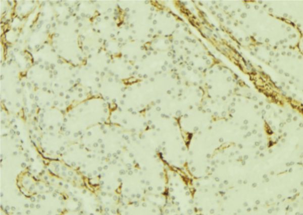 PGRMC1 / MPR Antibody - 1:100 staining mouse kidney tissue by IHC-P. The sample was formaldehyde fixed and a heat mediated antigen retrieval step in citrate buffer was performed. The sample was then blocked and incubated with the antibody for 1.5 hours at 22°C. An HRP conjugated goat anti-rabbit antibody was used as the secondary.