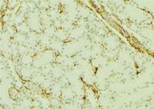 PGRMC1 / MPR Antibody - 1:100 staining mouse kidney tissue by IHC-P. The sample was formaldehyde fixed and a heat mediated antigen retrieval step in citrate buffer was performed. The sample was then blocked and incubated with the antibody for 1.5 hours at 22°C. An HRP conjugated goat anti-rabbit antibody was used as the secondary.