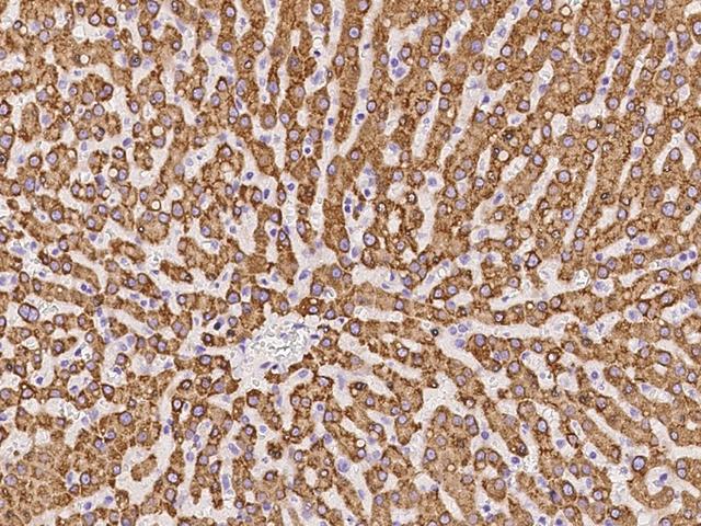 PGRMC1 / MPR Antibody - Immunochemical staining of human PGRMC1 in human liver with rabbit polyclonal antibody at 1:100 dilution, formalin-fixed paraffin embedded sections.