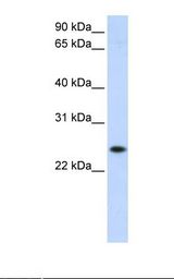 PGRMC1 / MPR Antibody - HepG2 cell lysate. Antibody concentration: 1.0 ug/ml. Gel concentration: 12%.  This image was taken for the unconjugated form of this product. Other forms have not been tested.