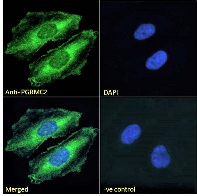 PGRMC2 Antibody - Goat Anti-PGRMC2 Antibody Immunofluorescence analysis of paraformaldehyde fixed HeLa cells, permeabilized with 0.15% Triton. Primary incubation 1hr (10ug/ml) followed by Alexa Fluor 488 secondary antibody (2ug/ml), showing plasma mamebrane and cytoplasmic staining. The nuclear stain is DAPI (blue). Negative control: Unimmunized goat IgG (10ug/ml) followed by Alexa Fluor 488 secondary antibody (2ug/ml).