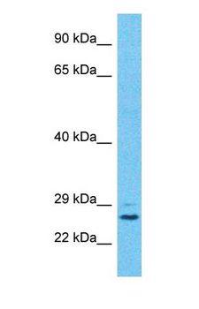 PGRMC2 Antibody - Western blot of PGRC2 Antibody with human 786-0 Whole Cell lysate.  This image was taken for the unconjugated form of this product. Other forms have not been tested.