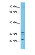 PGRMC2 Antibody - Western blot of PGRC2 Antibody with human Fetal Lung lysate.  This image was taken for the unconjugated form of this product. Other forms have not been tested.