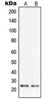 PGRMC2 Antibody - Western blot analysis of PGRMC2 expression in HL60 (A); HeLa (B) whole cell lysates.