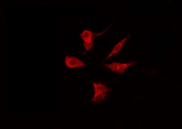 PGRMC2 Antibody - Staining HeLa cells by IF/ICC. The samples were fixed with PFA and permeabilized in 0.1% Triton X-100, then blocked in 10% serum for 45 min at 25°C. The primary antibody was diluted at 1:200 and incubated with the sample for 1 hour at 37°C. An Alexa Fluor 594 conjugated goat anti-rabbit IgG (H+L) Ab, diluted at 1/600, was used as the secondary antibody.