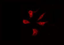 PGRMC2 Antibody - Staining HeLa cells by IF/ICC. The samples were fixed with PFA and permeabilized in 0.1% Triton X-100, then blocked in 10% serum for 45 min at 25°C. The primary antibody was diluted at 1:200 and incubated with the sample for 1 hour at 37°C. An Alexa Fluor 594 conjugated goat anti-rabbit IgG (H+L) Ab, diluted at 1/600, was used as the secondary antibody.