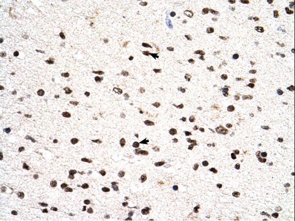 PGS1 Antibody - PGS1 antibody PGS1(phosphatidylglycerophosphate synthase 1) Antibody was used in IHC to stain formalin-fixed, paraffin-embedded human brain.  This image was taken for the unconjugated form of this product. Other forms have not been tested.