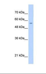 PGS1 Antibody - Jurkat cell lysate. Antibody concentration: 0.25 ug/ml. Gel concentration: 12%.  This image was taken for the unconjugated form of this product. Other forms have not been tested.