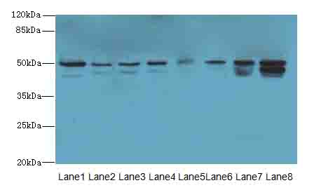 PGS1 Antibody - Western blot. All lanes: PGS1 antibody at 2 ug/ml. Lane 1: Mouse liver tissue. Lane 2: HeLa whole cell lysate. Lane 3: Jurkat whole cell lysate. Lane 4: HepG-2 whole cell lysate. Lane 5: Thp-1 whole cell lysate. Lane 6: Mouse spleen tissue. Lane 7: Mouse thymus tissue. Lane 8: Mouse kidney tissue. Secondary Goat polyclonal to Rabbit IgG at 1:10000 dilution. Predicted band size: 42 kDa. Observed band size: 47,50 kDa.