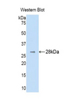 PH / PAH Antibody - Western blot of recombinant PH / PAH.  This image was taken for the unconjugated form of this product. Other forms have not been tested.