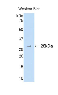PH / PAH Antibody - Western blot of recombinant PH / PAH.  This image was taken for the unconjugated form of this product. Other forms have not been tested.
