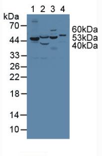 PH / PAH Antibody - Western Blot; Lane1: Human Liver Tissue; Lane2: Porcine Kidney Tissue; Lane3: Mouse Gallbladder Tissue; Lane4: Human Hela Cells.