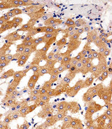 PH / PAH Antibody - Immunohistochemical of paraffin-embedded H. liver section using PAH Antibody. Antibody was diluted at 1:25 dilution. A peroxidase-conjugated goat anti-rabbit IgG at 1:400 dilution was used as the secondary antibody, followed by DAB staining.