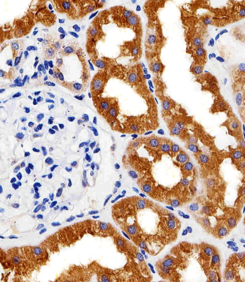 PH / PAH Antibody - Immunohistochemical of paraffin-embedded H. kidney section using PAH Antibody. Antibody was diluted at 1:25 dilution. A peroxidase-conjugated goat anti-rabbit IgG at 1:400 dilution was used as the secondary antibody, followed by DAB staining.