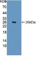 PH / PAH Antibody - Western Blot; Sample: Reombinant PAH, Human.