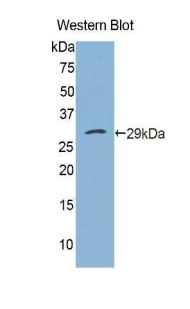 PH / PAH Antibody - Western blot of recombinant PH / PAH.  This image was taken for the unconjugated form of this product. Other forms have not been tested.