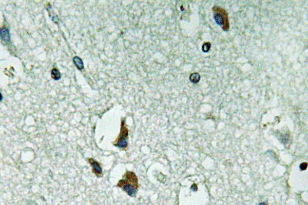 PH / PAH Antibody - IHC of PAH (R400) pAb in paraffin-embedded human brain tissue.