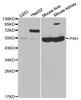 PH / PAH Antibody - Western blot analysis of extracts of various cell lines, using PAH antibody at 1:1000 dilution. The secondary antibody used was an HRP Goat Anti-Rabbit IgG (H+L) at 1:10000 dilution. Lysates were loaded 25ug per lane and 3% nonfat dry milk in TBST was used for blocking.