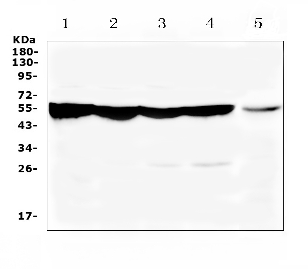 PH / PAH Antibody - Western blot analysis of PAH using anti-PAH antibody. Electrophoresis was performed on a 5-20% SDS-PAGE gel at 70V (Stacking gel) / 90V (Resolving gel) for 2-3 hours. The sample well of each lane was loaded with 50ug of sample under reducing conditions. Lane 1: rat liver tissue lysate,Lane 2: rat kidney tissue lysate,Lane 3: mouse liver tissue lysate,Lane 4: mouse kidney tissue lysate,Lane 5: human HepG2 whole cell lysate. After Electrophoresis, proteins were transferred to a Nitrocellulose membrane at 150mA for 50-90 minutes. Blocked the membrane with 5% Non-fat Milk/ TBS for 1.5 hour at RT. The membrane was incubated with rabbit anti-PAH antigen affinity purified polyclonal antibody at 0.5 µg/mL overnight at 4°C, then washed with TBS-0.1% Tween 3 times with 5 minutes each and probed with a goat anti-rabbit IgG-HRP secondary antibody at a dilution of 1:10000 for 1.5 hour at RT. The signal is developed using an Enhanced Chemiluminescent detection (ECL) kit with Tanon 5200 system. A specific band was detected for PAH at approximately 52KD. The expected band size for PAH is at 52KD.