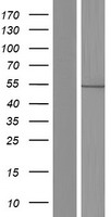 PH / PAH Protein - Western validation with an anti-DDK antibody * L: Control HEK293 lysate R: Over-expression lysate