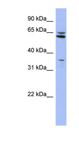 PH4 / P4HTM Antibody - P4HTM antibody Western blot of HepG2 cell lysate. This image was taken for the unconjugated form of this product. Other forms have not been tested.