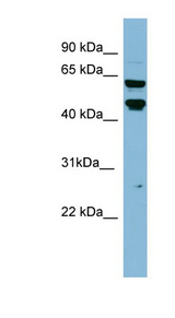 PH4 / P4HTM Antibody - P4HTM antibody Western blot of HT1080 cell lysate. This image was taken for the unconjugated form of this product. Other forms have not been tested.