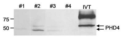 PH4 / P4HTM Antibody - Detection of Human PHD4 by Western Blot. Samples: Whole cell lysate (25 ug/lane) from human glioblastoma tumor cell lines or in vitro translated PHD4. Antibody: Affinity purified rabbit anti-PHD4 used at 2 ug/ml. Detection: Chemiluminescence.