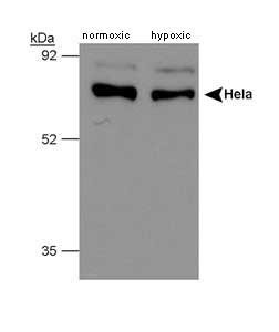 PH4 / P4HTM Antibody - Western blot of human PHD4. Samples: whole cell lysate from HeLa cells, normoxic and hypoxic, respectively.  This image was taken for the unconjugated form of this product. Other forms have not been tested.