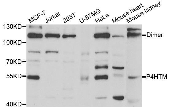 PH4 / P4HTM Antibody - Western blot analysis of extracts of various cell lines.