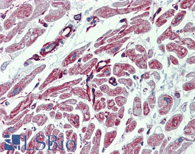 PHACTR1 Antibody - Anti-PHACTR1 antibody IHC of human heart. Immunohistochemistry of formalin-fixed, paraffin-embedded tissue after heat-induced antigen retrieval. Antibody concentration 5 ug/ml.  This image was taken for the unconjugated form of this product. Other forms have not been tested.