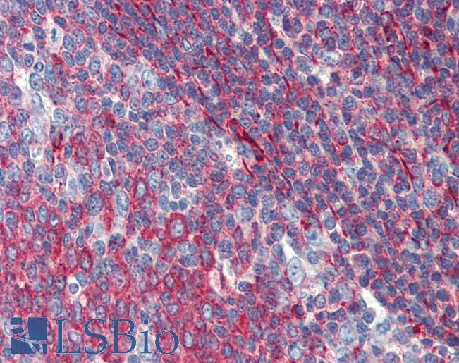 PHACTR1 Antibody - Anti-PHACTR1 antibody IHC of human tonsil. Immunohistochemistry of formalin-fixed, paraffin-embedded tissue after heat-induced antigen retrieval. Antibody concentration 5 ug/ml.  This image was taken for the unconjugated form of this product. Other forms have not been tested.