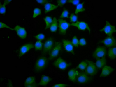 PHACTR1 Antibody - Immunofluorescence staining of A549 cells diluted at 1:133, counter-stained with DAPI. The cells were fixed in 4% formaldehyde, permeabilized using 0.2% Triton X-100 and blocked in 10% normal Goat Serum. The cells were then incubated with the antibody overnight at 4°C.The Secondary antibody was Alexa Fluor 488-congugated AffiniPure Goat Anti-Rabbit IgG (H+L).