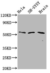 PHACTR1 Antibody - Western Blot Positive WB detected in: Hela whole cell lysate, SH-SY5Y whole cell lysate, Rat brain tissue All Lanes: PHACTR1 antibody at 6µg/ml Secondary Goat polyclonal to rabbit IgG at 1/50000 dilution Predicted band size: 67, 55 KDa Observed band size: 67 KDa