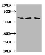 PHACTR1 Antibody - Western Blot Positive WB detected in: Hela whole cell lysate, Rat brain tissue, Mouse brain tissue All lanes: PHACTR1 antibody at 6µg/ml Secondary Goat polyclonal to rabbit IgG at 1/50000 dilution Predicted band size: 67, 55 kDa Observed band size: 67 kDa
