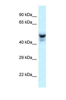 PHACTR3 Antibody - PHACTR3 antibody Western blot of Mouse Liver lysate. Antibody concentration 1 ug/ml.  This image was taken for the unconjugated form of this product. Other forms have not been tested.